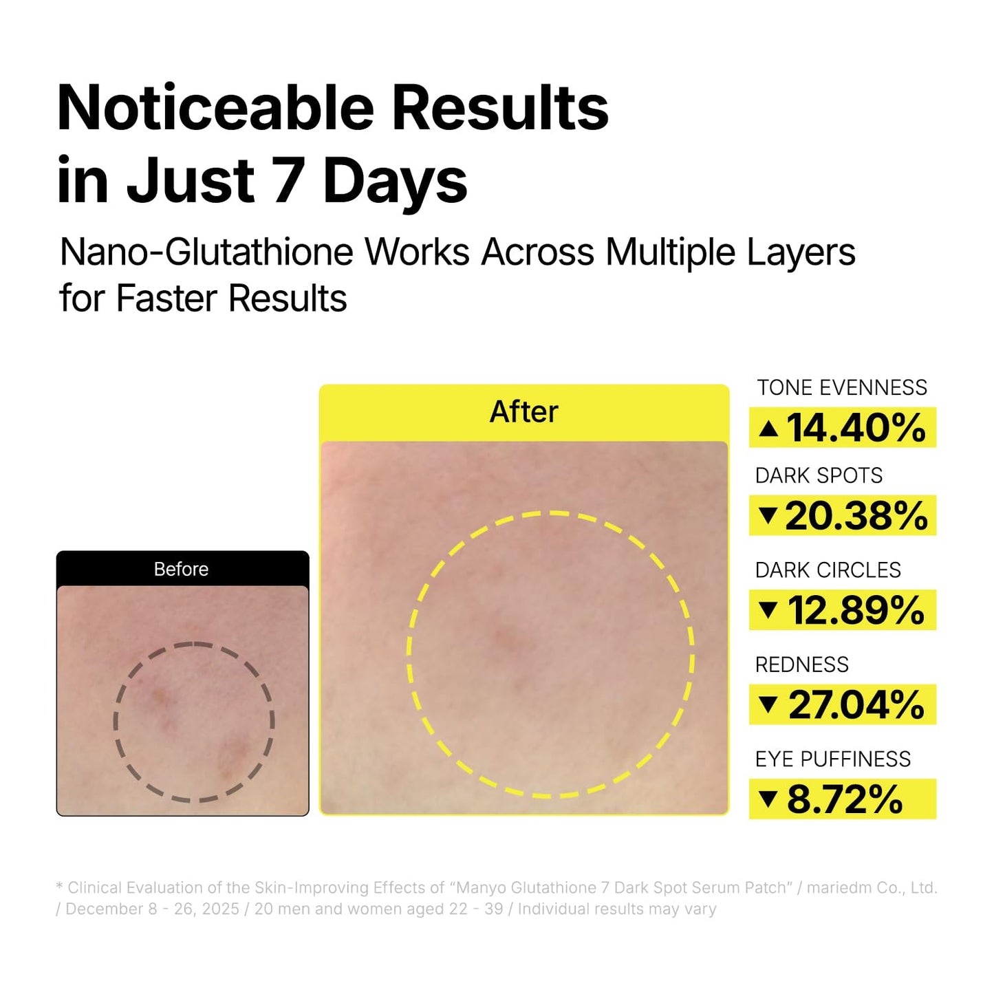 Glutathione Dark Spot Serum Patches