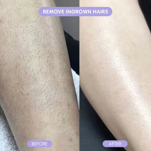 Hair Removal Mousse