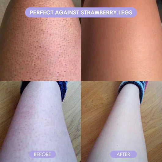 Hair Removal Mousse