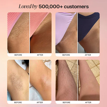Dermave™ Trimmer 2.0